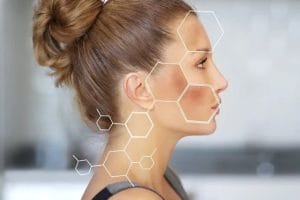 Bị nám da mặt phải làm sao