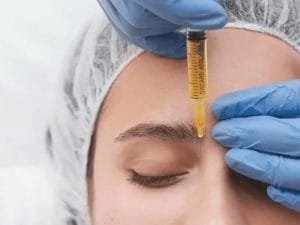 Biến chứng tiêm meso và những điều cần lưu ý trước khi điều trị