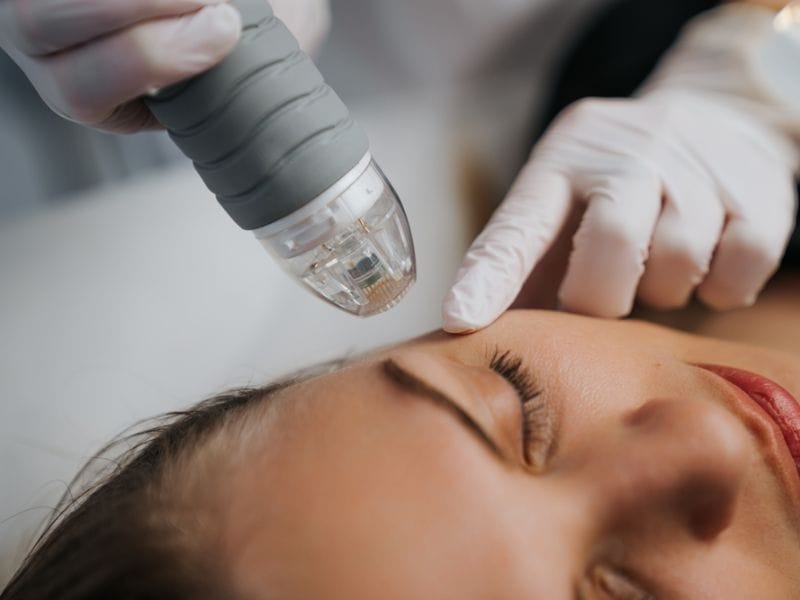 Sự khác nhau giữa phương pháp meso không tiêm và truyền thống