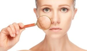 Những cách điều trị lão hoá da mặt hiệu quả 